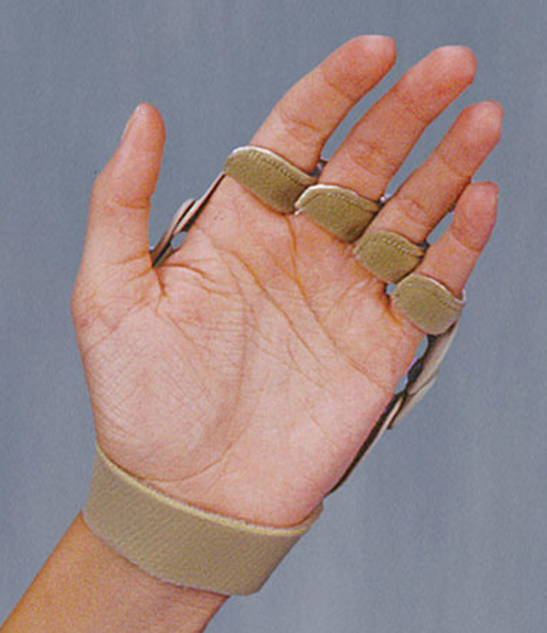 Polycentric Hinged Ulnar Deviation Splint