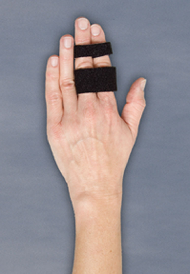 Finger sprain splint - Buddy Loop