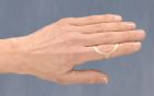 Oval-8 splint from 3-Point Products  helps relieve finger pain caused by arthritis