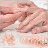 Oval-8's treat mallet finger, swan neck and boutonniere deformities,trigger finger and trigger thumb, lateral deviation, fractures, arthritis, and hypermobility (EDS) Oval-8's treat mallet finger, swan neck and boutonniere deformities,trigger finger and trigger thumb, lateral deviation, fractures, arthritis, and hypermobility (EDS)