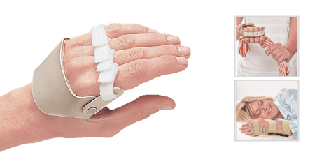 3 Hand Splints For Ulnar Deviation