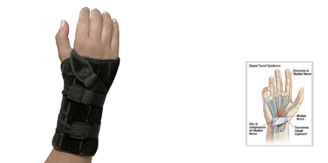 3pp® Choice Wrist Brace | 3 Point Products
