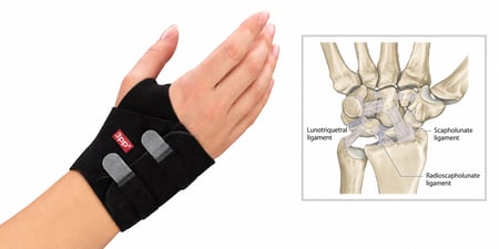 Hand wearing a 3pp Carpal Lift wrist brace beside an illustration of wrist ligaments associated with ulnar-sided wrist pain and lunotriquetral dissociation.