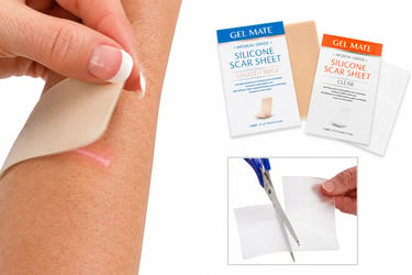 Gel Mate™ silicone scar sheets shown being applied to a healing scar, available in Smooth Beige and Clear options, with a custom trimming demonstration for adherent scar management.