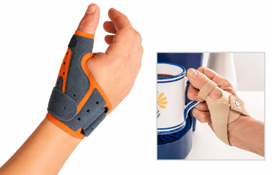 Thumb Deformity: Treating Thenar Wasting With a Splint