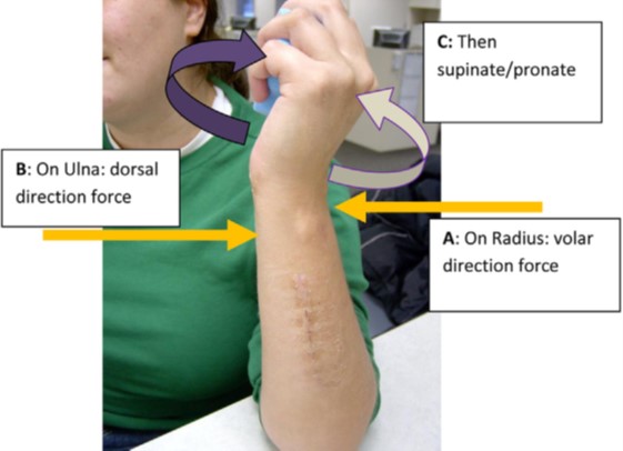 orthotic management of the distal radioulnar joint druj radioulnar joint