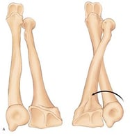 radius around the ulna wrist bone