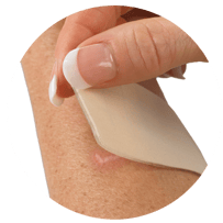 Close-up of a hand peeling back a beige Gel Mate® silicone gel sheet from the skin to reveal a healed scar underneath. The reusable silicone sheet is designed to help soften, flatten, and protect scars while cushioning sensitive skin.