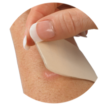 Close-up of a hand peeling back a beige Gel Mate® silicone gel sheet from the skin to reveal a healed scar underneath. The reusable silicone sheet is designed to help soften, flatten, and protect scars while cushioning sensitive skin.