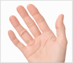 A nude-colored Oval-8 finger splint positioned on the ring finger to stabilize the joint while keeping the palm and other fingers free.