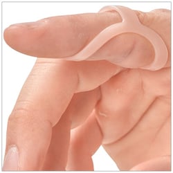 Boutonniere Deformity treated with an Oval-8 Finger Splint