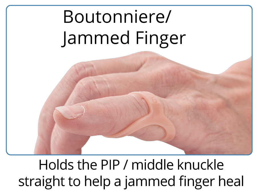 The Original Oval8 Finger Splints 3Point Products