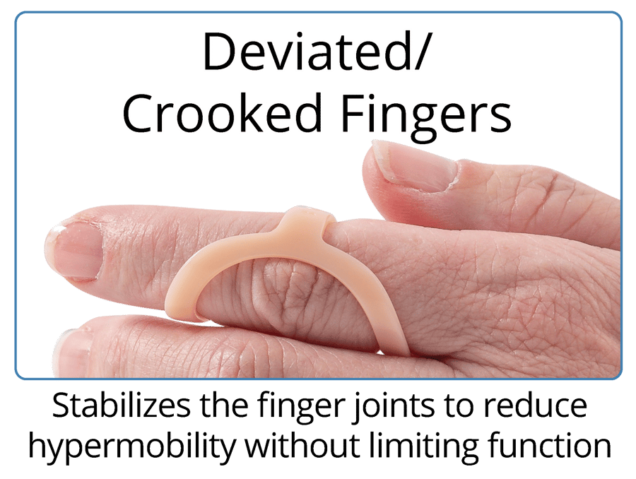The Original Oval8 Finger Splints 3Point Products