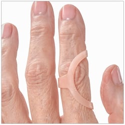 Lateral Deviation treated with an Oval-8 Finger Splint