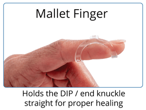 oval-8 finger splints for mallet finger