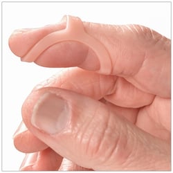 Mallet finger treated with an Oval-8 Finger splint