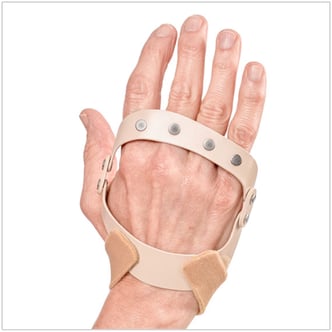 The Polycentric Hinted Ulnar Deviation Splint restores MP joint alignment with mild to moderate force The Polycentric Hinted Ulnar Deviation Splint restores MP joint alignment with mild to moderate force