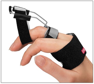 3pp Step Up Splint restores PIP and DIP extension using static progressive tension