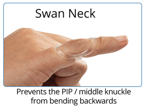 oval-8 finger splints for swan neck deformity