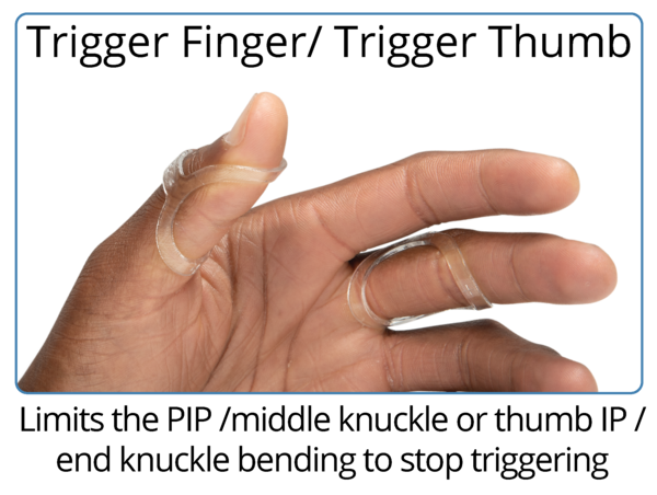 The Original Oval-8 Finger Splints | 3-Point Products