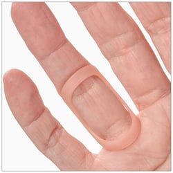 Trigger finger treated with an Oval-8 Finger Splint