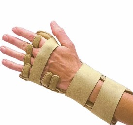 Rheumatoid Arthritis and Night Time Orthosis Use