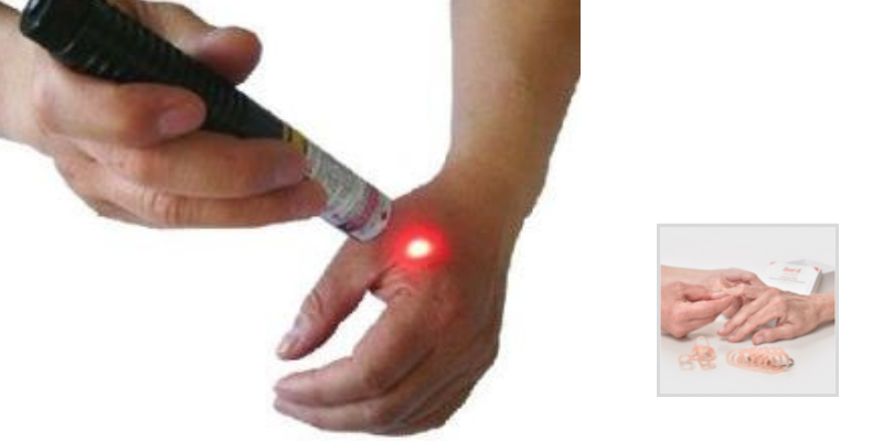 Using Low Level Lasers for Hand Therapy Treatments
