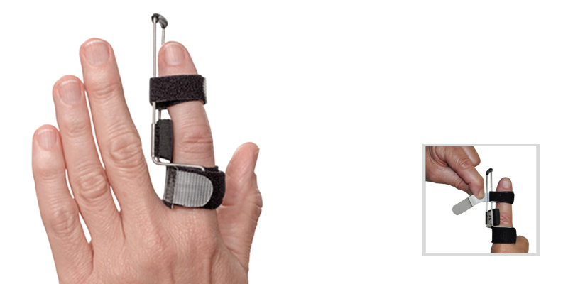 Announcing an Improved Design for the 3pp Side Step Splint