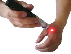 Using Low Level Lasers for Hand Therapy Treatments