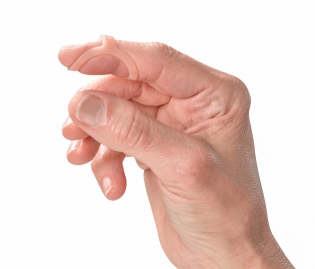 How to Treat a Mallet Finger with an Oval-8: Video Blog