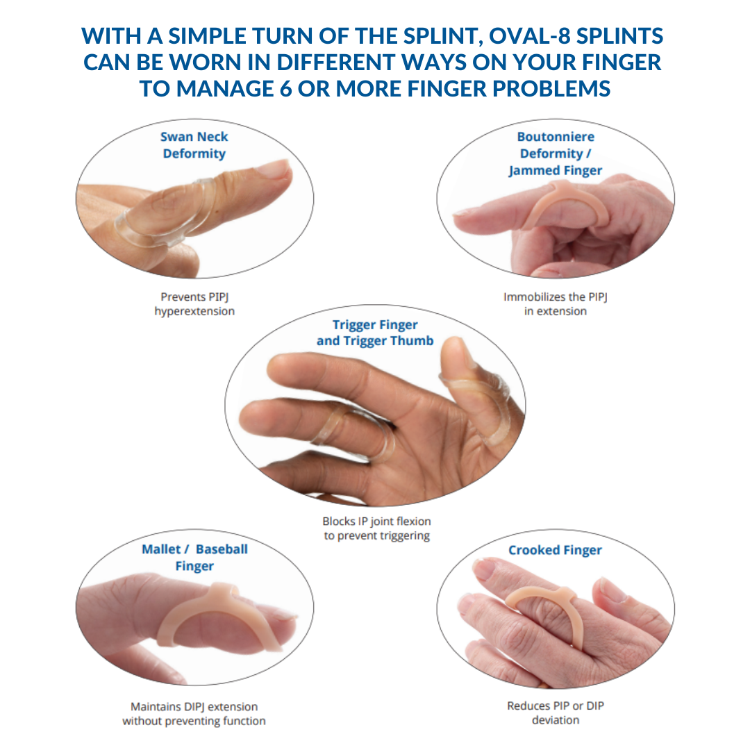 Oval-8 Finger Splints Sizing Information