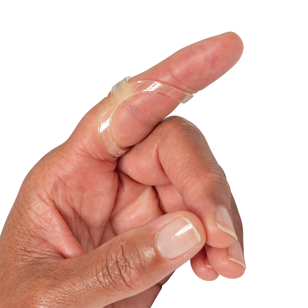 Oval-8 finger splints