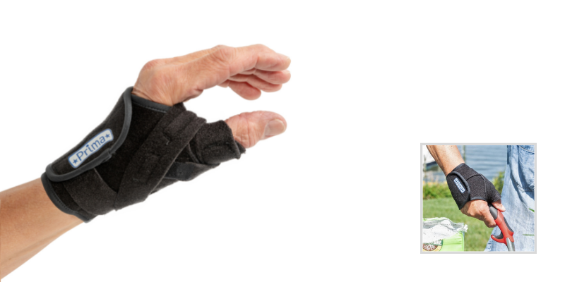 A Comparison of Thumb Arthritis Splints